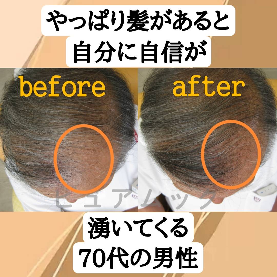 髪があると自分に自信が湧いてくる70代男性